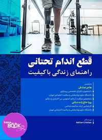 قطع اندام تحتانی راهنمای زندگی با کیفیت