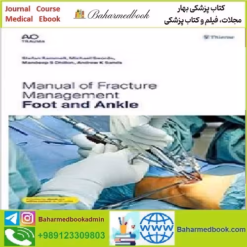 Manual of Fracture Management Foot and Ankle TRUE PDF pric