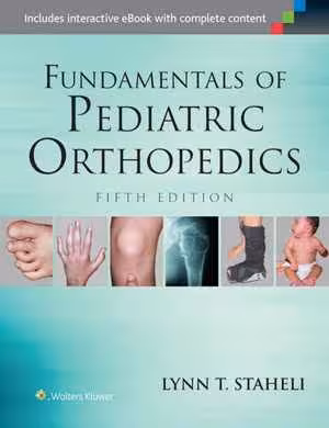 [EPUB] دانلود کتاب Fundamentals Of Pediatric Orthopedics, 5th ed, 2016