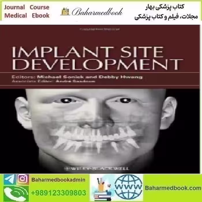Implant Site Development 2012 TRUE PDF price 1€ - کتاب پزشکی بهار