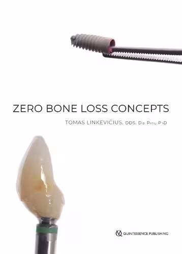 خرید و دانلود نسخه کامل کتاب Zero Bone Loss Concepts