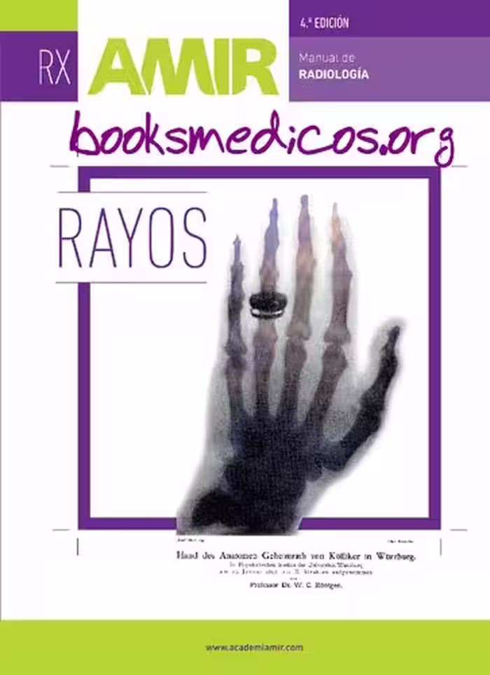 خرید و دانلود نسخه کامل کتاب Radiología