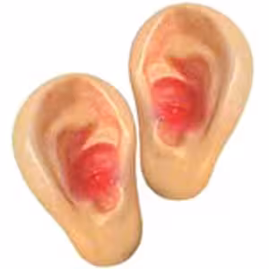 گوش دراکولا بزرگ