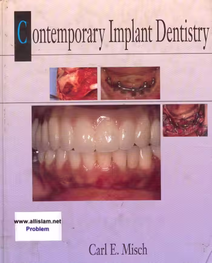 خرید و دانلود نسخه کامل کتاب Contemporary Implant Dentistry