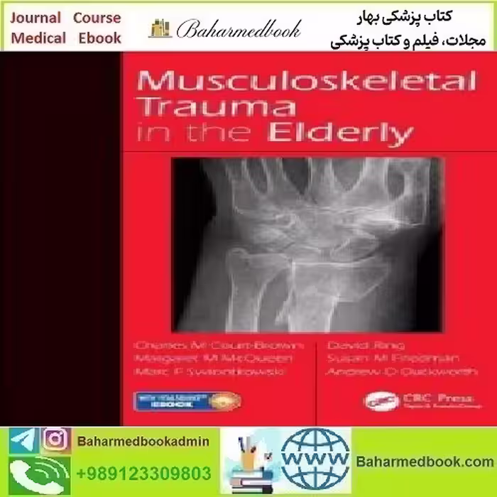 Musculoskeletal Trauma in the Elderly 2017 TRUE PDF price 1€ - کتاب پزشکی بهار