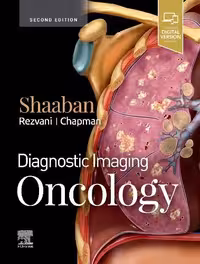 خرید و دانلود نسخه کامل کتاب Diagnostic Imaging: Oncology, 2e (2020)