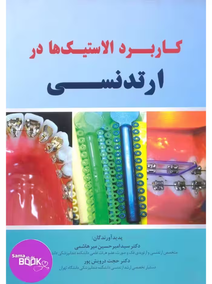 کاربرد الاستیک ها در ارتدنسی