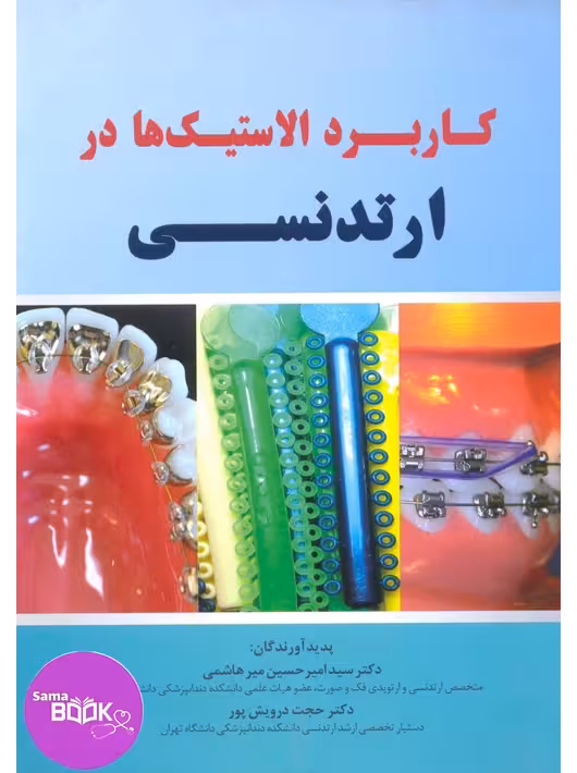 کاربرد الاستیک ها در ارتدنسی