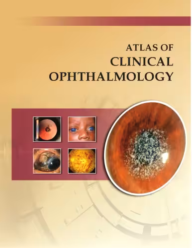 خرید و دانلود نسخه کامل کتاب Atlas of Clinical Ophthalmology