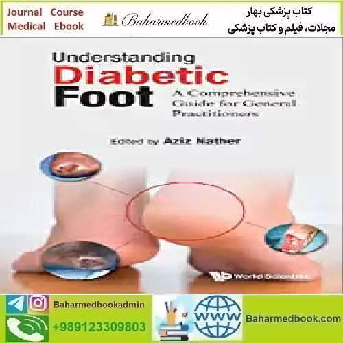 Understanding Diabetic Foot A Comprehensive Guide