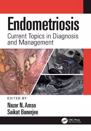 خرید و دانلود نسخه کامل کتاب Endometriosis: Current Topics in Diagnosis and Management