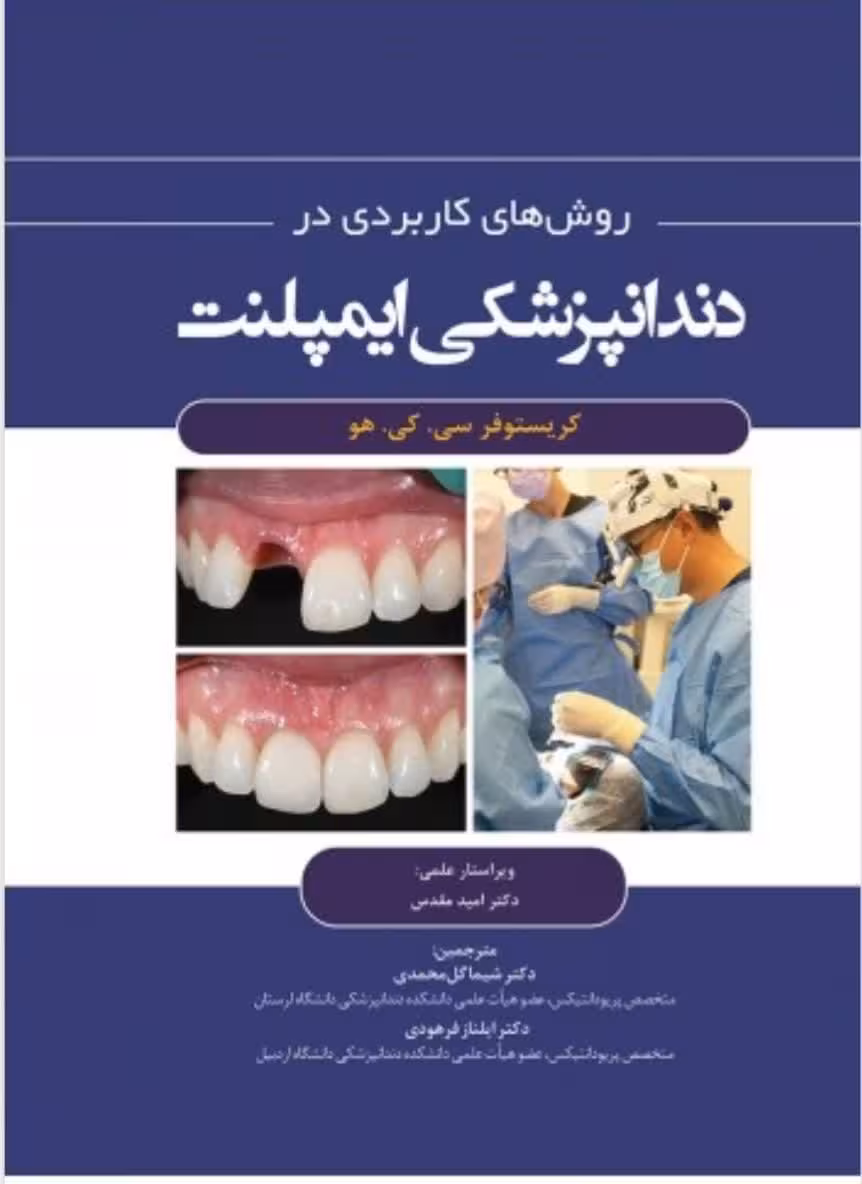 روشهای کاربردی در دندانپزشکی ایمپلنت 2021