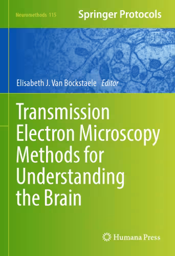 خرید و دانلود نسخه کامل کتاب Transmission Electron Microscopy Methods for Understanding the Brain