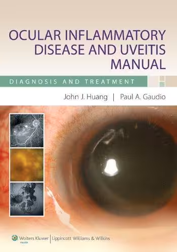 خرید و دانلود نسخه کامل کتاب Ocular Inflammatory Disease and Uveitis Manual: Diagnosis and Treatment