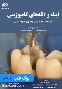 اینله و آنله های کامپوزیتی