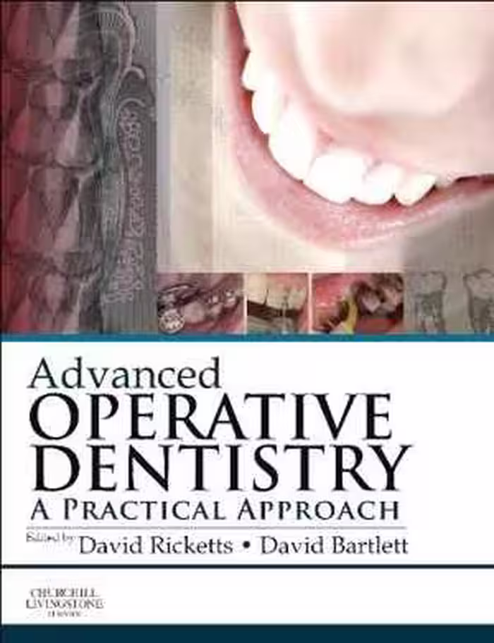 [PDF] دانلود کتاب Advanced Operative Dentistry, 2011