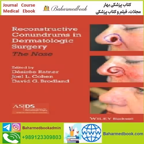 Reconstructive Conundrums in Dermatologic Surgery TRUE PD