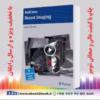 Radcases Breast Imaging