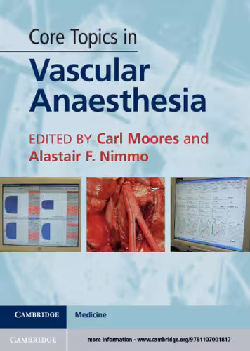 خرید و دانلود نسخه کامل کتاب Core Topics in Vascular Anaesthesia