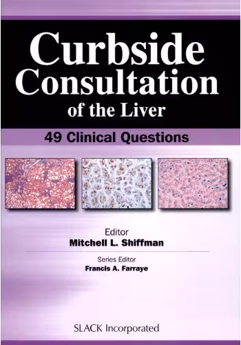 خرید و دانلود نسخه کامل کتاب Curbside Consultation of the Liver: 49 Clinical Questions