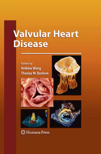 خرید و دانلود نسخه کامل کتاب Valvular Heart Disease
