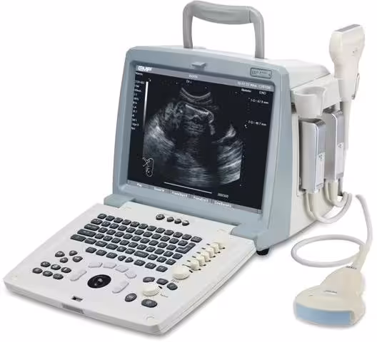 دستگاه سونوگرافی پرتابل Full Digital مدل Emp 820 Plus