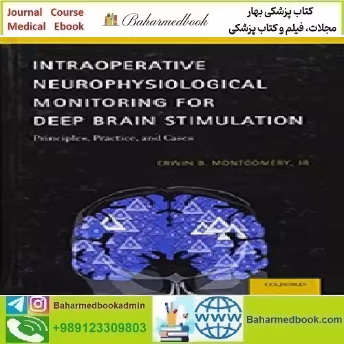 Intraoperative Neurophysiological Monitoring for Deep Brain Stim