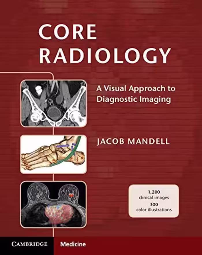 خرید و دانلود نسخه کامل کتاب Core Radiology: A Visual Approach to Diagnostic Imaging - Orginal Pdf