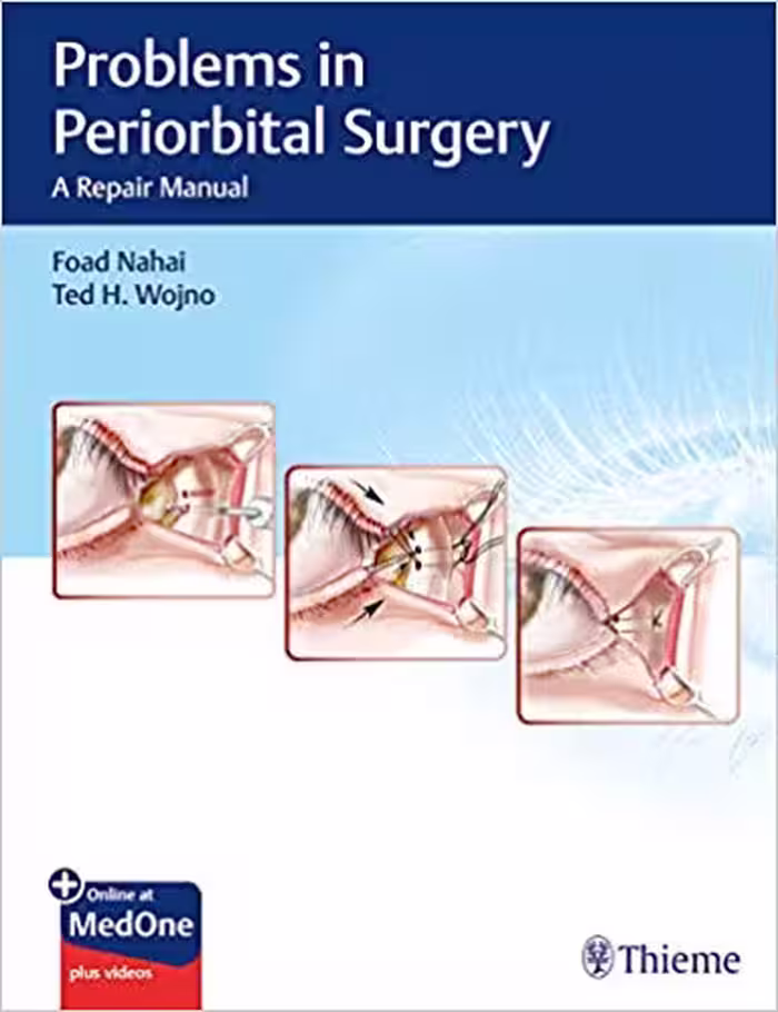 خرید و دانلود نسخه کامل کتاب Problems in Periorbital Surgery: A Repair Manual