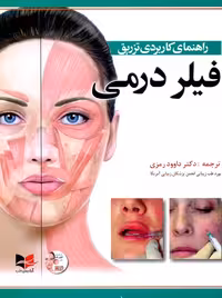 راهنمای کاربردی تزریق فیلر درمی رمزی آبادیس طب