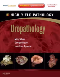 خرید و دانلود نسخه کامل کتاب Uropathology: A Volume in the High Yield Pathology Series