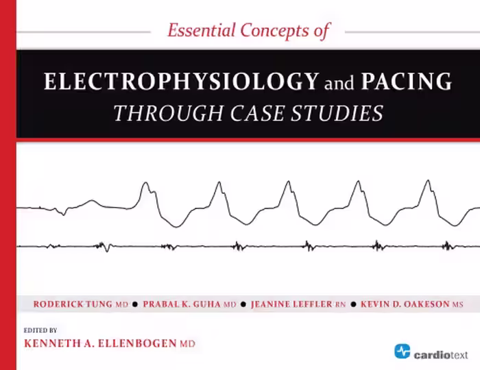 خرید و دانلود نسخه کامل کتاب Essential Concepts of Electrophysiology and Pacing through Case Studies