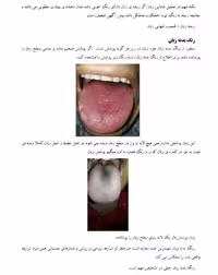 آموزش زبان شناسی دوره مقدماتی و پیشرفته و تشخیص بیماری