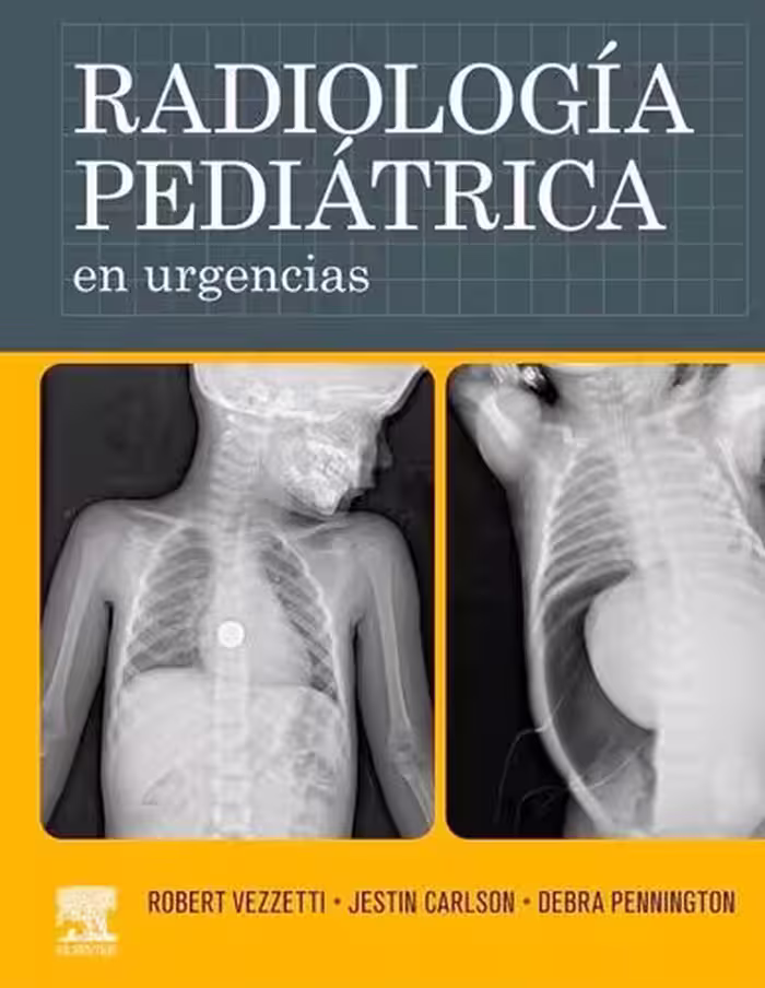 خرید و دانلود نسخه کامل کتاب Radiologia Pediatrica En Urgencias