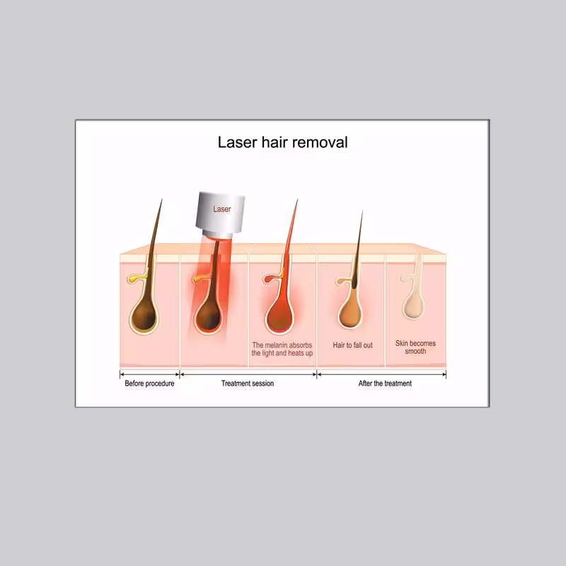 تابلو شاسی مدل لیزر پوست کد 127 | دنیای قاب