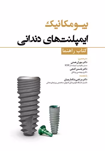 بیومکانیک ایمپلنتهای دندانی