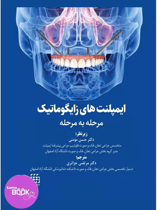 ایمپلنت های زایگوماتیک (مرحله به مرحله)