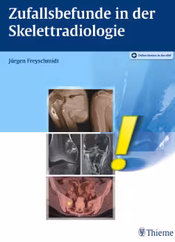 خرید و دانلود نسخه کامل کتاب Zufallsbefunde in der Skelettradiologi - Original PDF