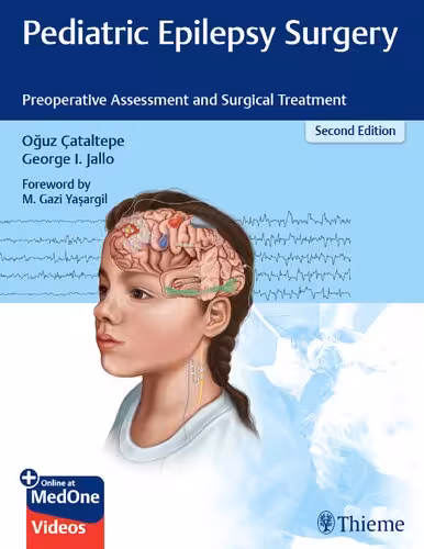 خرید و دانلود نسخه کامل کتاب Pediatric Epilepsy Surgery: Preoperative Assessment and Surgical Treatment