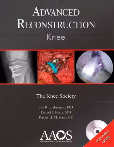 خرید و دانلود نسخه کامل کتاب Advanced Reconstruction: Knee