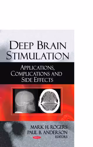 خرید و دانلود نسخه کامل کتاب Deep Brain Stimulation: Applications, Complications and Side Effects