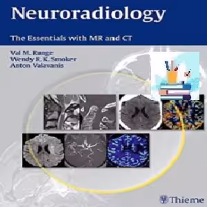Neuroradiology TRUE PDF price 1€