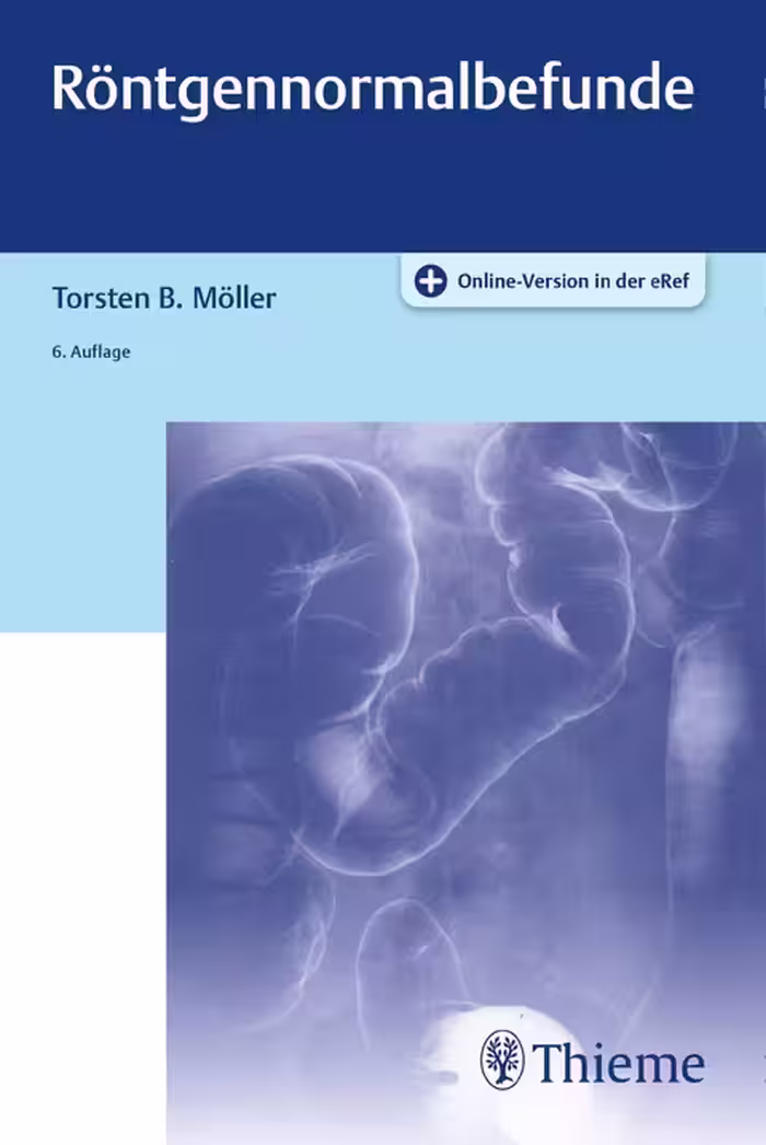 خرید و دانلود نسخه کامل کتاب Röntgennormalbefunde BY Möller - Orginal Pdf
