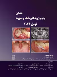 پاتولوژی دهان، فک و صورت نویل 2024 جلد اول