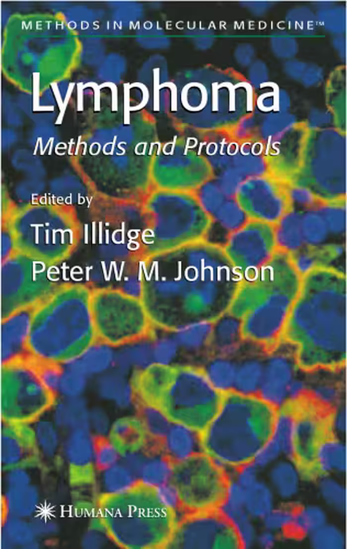 خرید و دانلود نسخه کامل کتاب Lymphoma (Methods in Molecular Medicine)