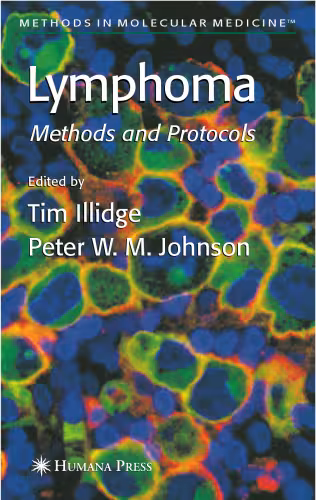 خرید و دانلود نسخه کامل کتاب Lymphoma (Methods in Molecular Medicine)