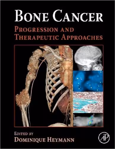 خرید و دانلود نسخه کامل کتاب Bone Cancer: Progression and Therapeutic Approaches