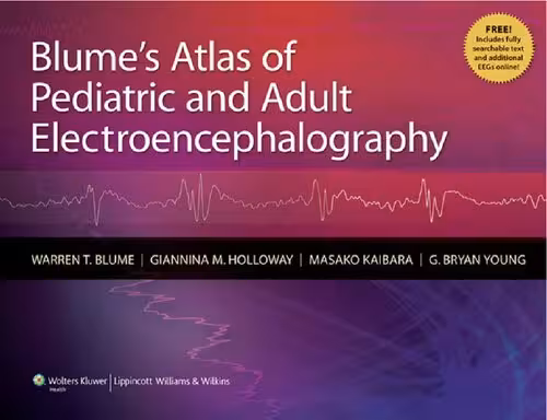 خرید و دانلود نسخه کامل کتاب Blume's Atlas of Pediatric and Adult Electroencephalography
