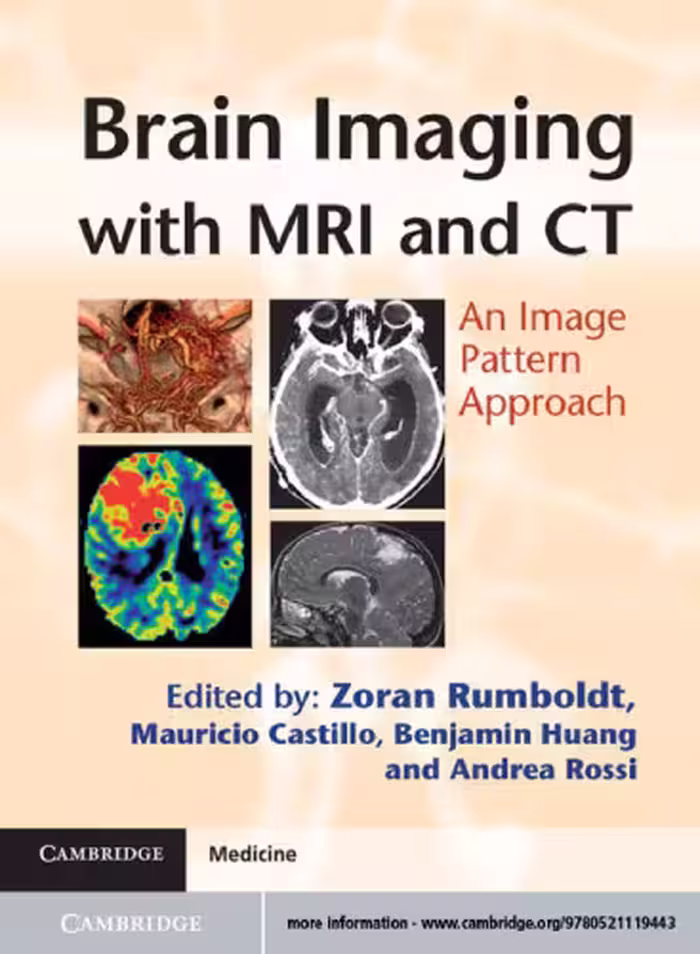 خرید و دانلود نسخه کامل کتاب Brain Imaging with MRI and CT: An Image Pattern Approach