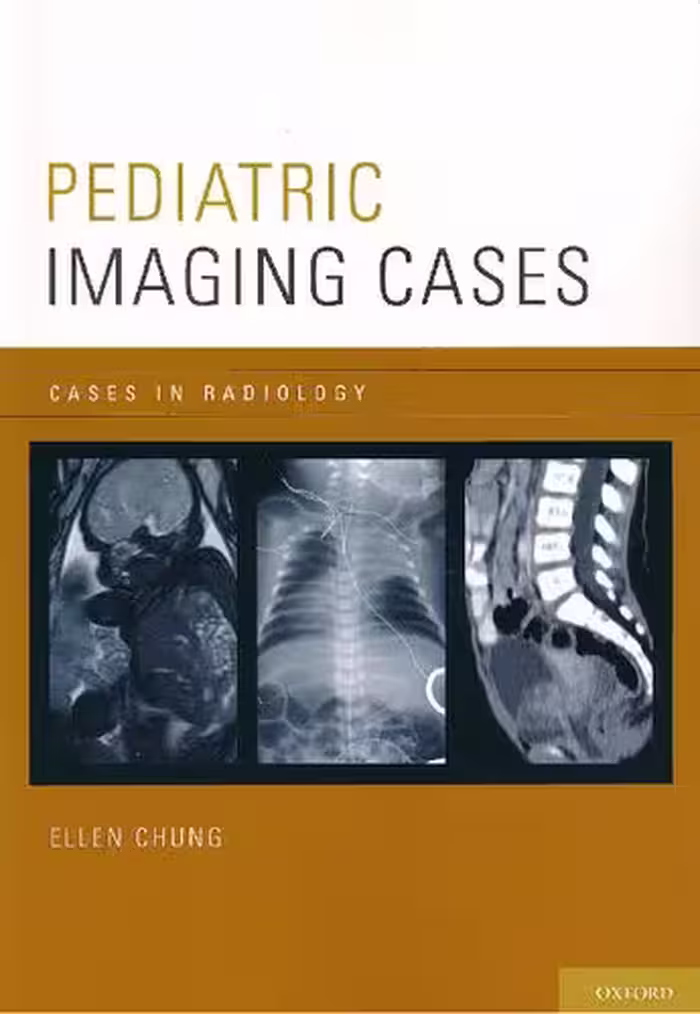 خرید و دانلود نسخه کامل کتاب Pediatric Imaging Cases (Cases in Radiology)